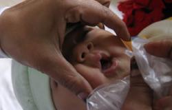 انطلاق الحملة القومية للتطعيم ضد شلل الأطفال..الأسبوع المقبل