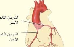 تحذير لمرضى الشريان التاجى.. حرارة الجو تعرضكم للإصابة بالذبحة الصدرية