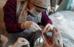 تدريب طلاب طب أسنان القاهرة فى جراحة ضمور اللثة على رؤوس الخراف