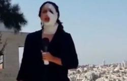 بالفيديو.. مراسلة فلسطينية تواصل عملها رغم إحراق وجهها من قبل قوات الاحتلال