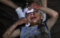 مقتل 35 عاملا طبيا ومريضا فى غارات استهدفت 12 مستشفى فى سوريا
