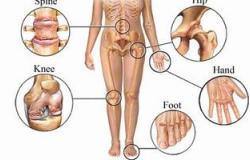 الروماتيزم مش مرض.. دا وصف لآلام الجهاز الحركى بالجسم