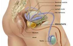 احتقان البروستاتا أسبابه وأهم المضاعفات.. اعرفها واحمى نفسك