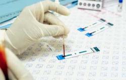 الصحة: اكتشاف حالة مصابة بالإيدز بكفر الشيخ ولا داعى للقلق