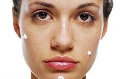 ماسك الزعتر لعلاج حب الشباب يخلصك من حساسية الجلد ويزيل البثور
