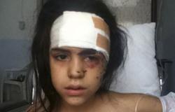 منظمة إنقاذ الطفولة: قصف مستشفى ولادة فى إدلب
