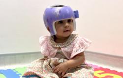 خوذة لعلاج متلازمة الرأس المسطح عند الأطفال