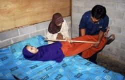 بالصور.. إندونيسية تعانى من مرض نادر يجعلها غير قادرة على الانحناء